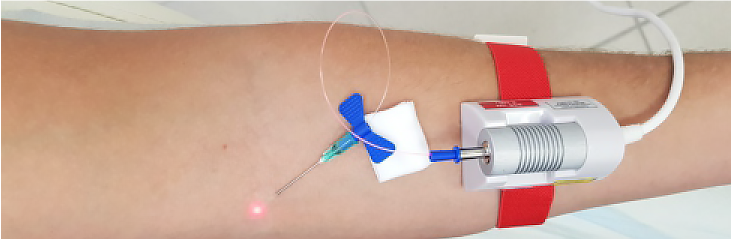 Курс из 10 процедур — 8000 руб.
