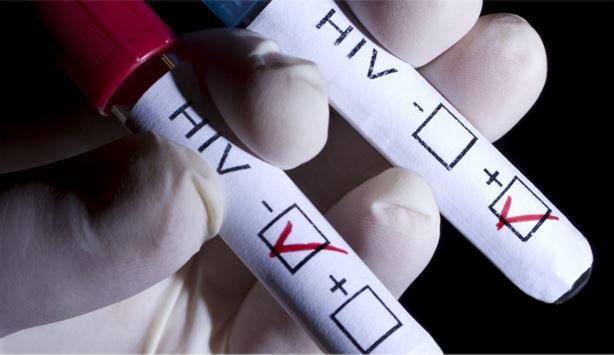 Анализ на ВИЧ-инфекцию. Знай свой статус!
