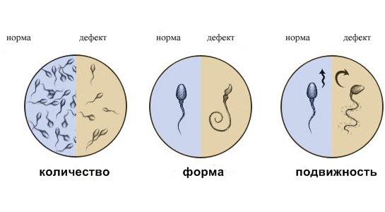 Спермограмма с углубленной морфологией эякулята по Крюгеру